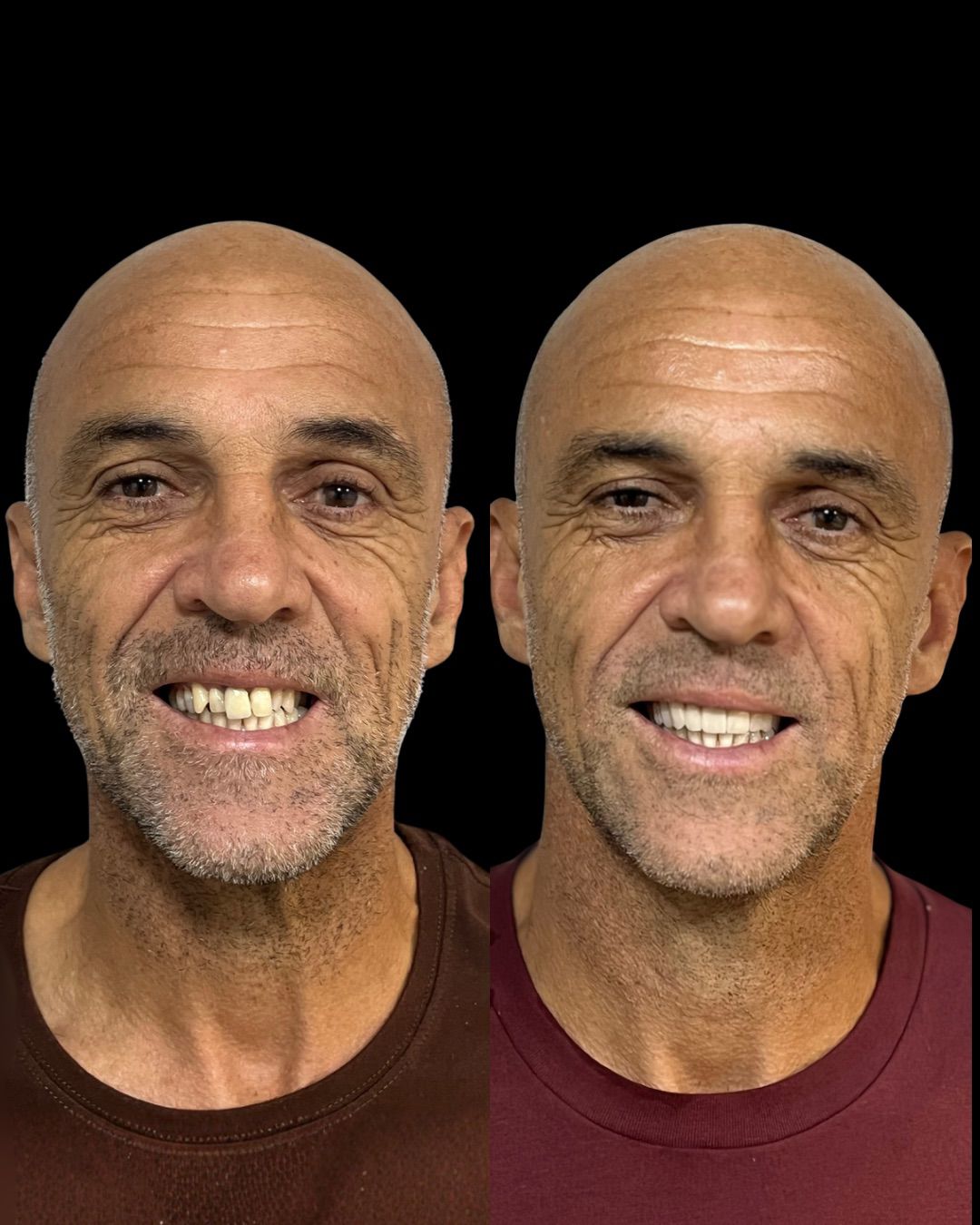 Periodontia